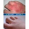 Fresh Skin Before and After