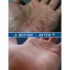 Fresh Skin Before and After