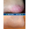 Fresh Skin Before and After