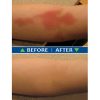 Fresh Skin Before and After