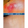 Fresh Skin Before and After